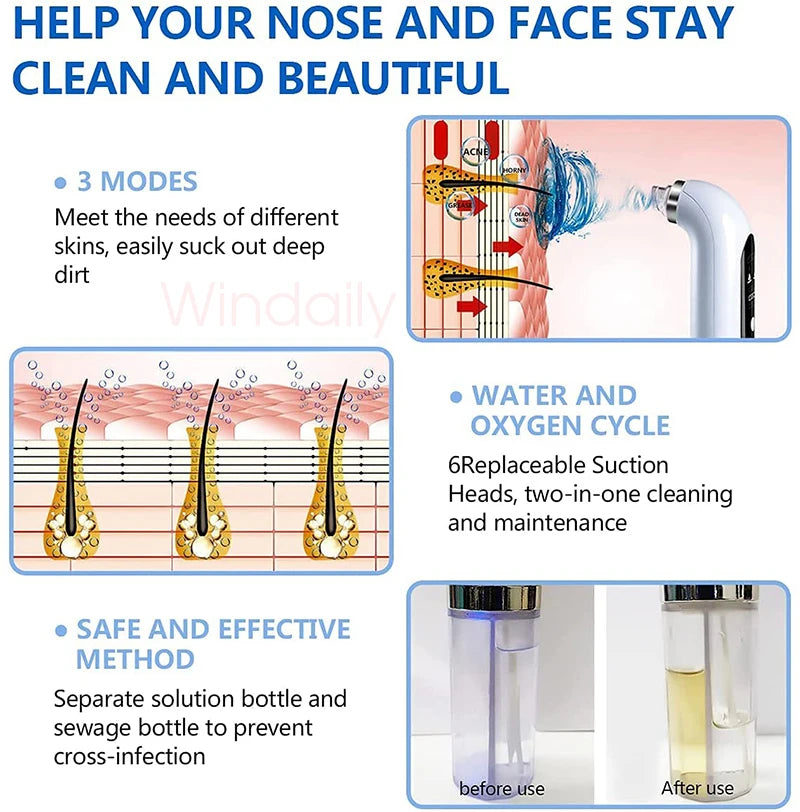 2025 Blackhead Remover Vacuum – Electric Pore Cleaner & Facial Device