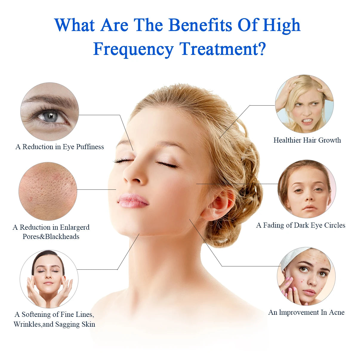 Blue 6-in-1 High Frequency Facial Machine